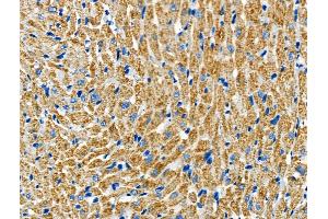 ABIN6265546 and ABIN6266641 at 1/100 staining Rat heart tissue by IHC-P. (TGFB2 抗体  (C-Term))
