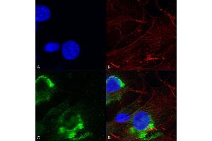 Immunocytochemistry/Immunofluorescence analysis using Mouse Anti-GFAP R416WT Monoclonal Antibody, Clone S206B-9 (ABIN1740964). (GFAP 抗体  (AA 411-422) (Atto 390))