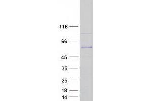 Western Blotting (WB) image for Calcium/calmodulin-Dependent Protein Kinase II beta (CAMK2B) (Transcript Variant 5) protein (Myc-DYKDDDDK Tag) (ABIN2713088)