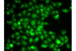 Immunofluorescence analysis of A549 cells using TRAF4 antibody. (TRAF4 抗体)
