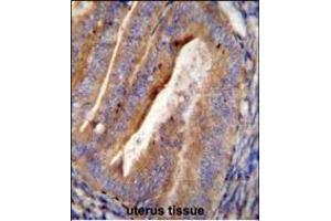 OGN Antibody (C-term) (ABIN655617 and ABIN2845097) immunohistochemistry analysis in formalin fixed and paraffin embedded human uterus tissue followed by peroxidase conjugation of the secondary antibody and DAB staining. (OGN 抗体  (C-Term))