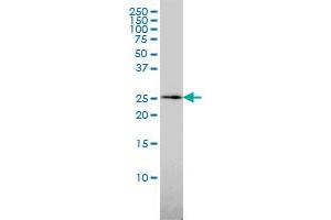 QDPR monoclonal antibody (M02), clone M1 Western Blot analysis of QDPR expression in HL-60 .