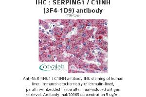 Image no. 1 for anti-Serpin Peptidase Inhibitor, Clade G (C1 Inhibitor), Member 1 (SERPING1) (AA 1-501), (full length) antibody (ABIN1723814) (SERPING1 抗体  (full length))