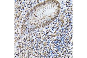 Immunohistochemistry of paraffin-embedded human appendix using hnRNPM antibody (ABIN6128031, ABIN6141919, ABIN6141920 and ABIN6222681) at dilution of 1:100 (40x lens).