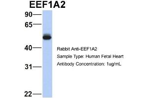 Host:  Rabbit  Target Name:  EEF1A2  Sample Type:  Human Fetal Heart  Antibody Dilution:  1. (EEF1A2 抗体  (Middle Region))