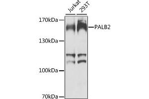 Western blot analysis of extracts of various cell lines, using P antibody (ABIN6128412, ABIN6145192, ABIN6145193 and ABIN6224413) at 1:1000 dilution. (PALB2 抗体  (AA 99-198))