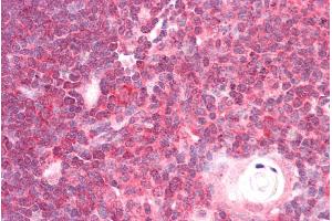 ABIN185580 (5µg/ml) staining of paraffin embedded Human Thymus.