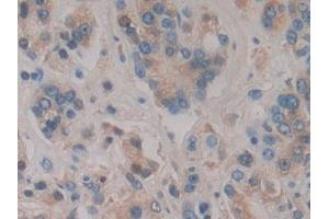 Immunohistochemistry (IHC) image for anti-Haptoglobin Related Protein (HPR) (AA 70-332) antibody (ABIN7443218)