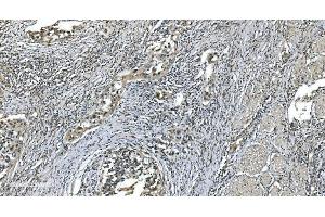 IHC analysis of LSM7 using anti-LSM7 antibody (ABIN7598937). (LSM7 抗体  (AA 1-103))