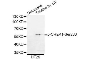 Western blot analysis of extracts of HT-29 cells, using Phospho-CHEK1-Ser280 antibody (ABIN5969878). (CHEK1 抗体  (pSer280))