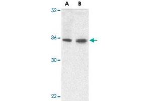 Western blot analysis of TRIM5 gamma expression in human bladder (A) and colon (B) tissue lysate with TRIM5 gamma polyclonal antibody  at 2 ug /mL . (TRIM5 抗体  (C-Term))