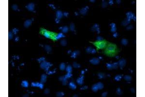 Anti-SHPK mouse monoclonal antibody (ABIN2454805) immunofluorescent staining of COS7 cells transiently transfected by pCMV6-ENTRY SHPK (RC204421). (SHPK 抗体)