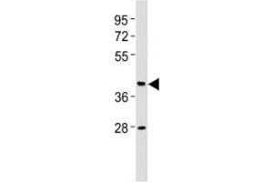 Western blot testing of CB2 antibody at 1:2000 dilution + human brain lysate. (CNR2 抗体  (AA 18-53))