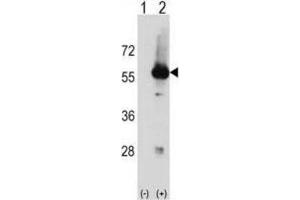 Western Blotting (WB) image for anti-serine/threonine Kinase 3 (STK3) antibody (ABIN2998524) (STK3 抗体)