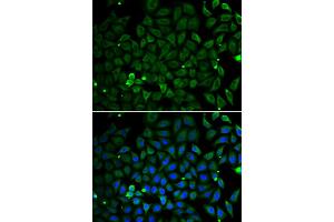 Immunofluorescence analysis of A549 cells using PARK2 antibody (ABIN5998454). (Parkin 抗体)