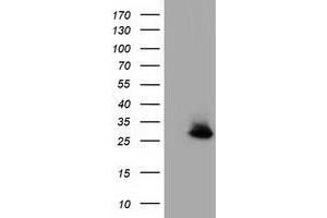 Western Blotting (WB) image for anti-Glutathione S-Transferase theta 2 (GSTT2) antibody (ABIN1498558) (GSTT2 抗体)