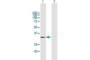Western Blot analysis of LGALS8 expression in transfected 293T cell line by LGALS8 MaxPab polyclonal antibody. (LGALS8 抗体  (AA 1-317))