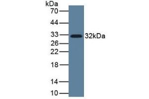 Detection of IL33 in Human Lung Tissue using Monoclonal Antibody to Interleukin 33 (IL33) (IL-33 抗体  (AA 112-270))