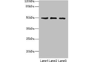 Western blot All lanes: CSNK1G1 antibody at 1. (CSNK1G1 抗体  (Isoform gamma 1))