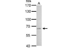 Western Blotting (WB) image for anti-Plasminogen Activator, Tissue (PLAT) antibody (ABIN2855635)
