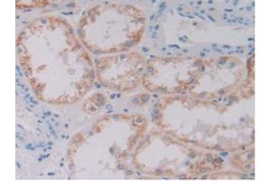 IHC-P analysis of Human Kidney Tissue, with DAB staining. (GDF6 抗体  (AA 336-455))