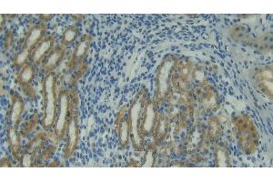 Immunohistochemistry (IHC) image for anti-Tumor Necrosis Factor (Ligand) Superfamily, Member 10 (TNFSF10) (AA 115-287) antibody (ABIN7431167)