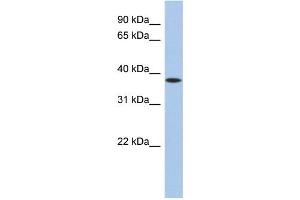 Western Blotting (WB) image for anti-Zinc Finger Protein 36, C3H Type, Homolog (Mouse) (ZFP36) (N-Term) antibody (ABIN2775765)