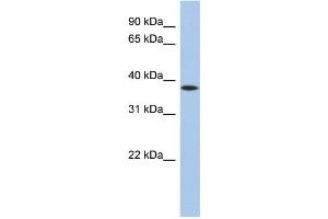 WB Suggested Anti-ZFP36 Antibody Titration:  0. (ZFP36 抗体  (N-Term))