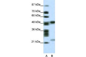 WB Suggested Anti-PHF11 Antibody Titration:  0. (PHF11 抗体  (Middle Region))