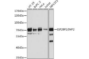 Western blot analysis of extracts of various cell lines, using IGF2BP2/IMP2 antibody (ABIN6131799, ABIN6142242, ABIN6142244 and ABIN6218878) at 1:1000 dilution. (IGF2BP2 抗体  (AA 330-599))