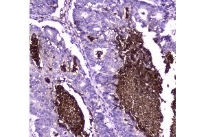 IHC analysis of Lactoferrin using anti-Lactoferrin antibody . (Lactoferrin 抗体  (AA 529-710))