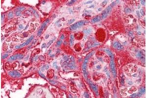 Human Placenta: Formalin-Fixed, Paraffin-Embedded (FFPE) (APOA2 抗体  (AA 1-100))
