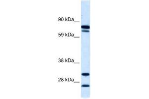 ZNF606 antibody used at 5 ug/ml to detect target protein. (ZNF606 抗体  (N-Term))