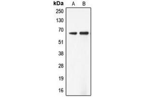 Western blot analysis of ADCK5 expression in Jurkat (A), SW13 (B) whole cell lysates. (ADCK5 抗体  (Center))