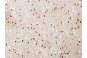 Immunoperoxidase of monoclonal antibody to SMAD6 on formalin-fixed paraffin-embedded human esophagus. (SMAD6 抗体  (AA 285-384))