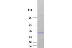 Western Blotting (WB) image for Stromal Cell Derived Factor 2 (SDF2) protein (Myc-DYKDDDDK Tag) (ABIN2731522)