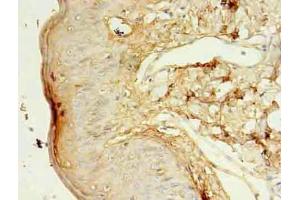 Immunohistochemistry of paraffin-embedded human skin tissue using ABIN7157213 at dilution of 1:100 (Kallikrein 5 抗体  (AA 23-293))