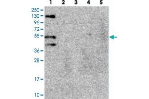 Western blot analysis of Lane 1: RT-4, Lane 2: U-251 MG, Lane 3: Human Plasma, Lane 4: Liver, Lane 5: Tonsil with FUZ polyclonal antibody . (FUZ 抗体)