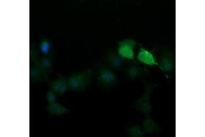 Image no. 1 for anti-SEC14 and Spectrin Domains 1 (SESTD1) antibody (ABIN1501065)