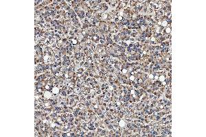 IHC analysis of SFXN3 using anti-SFXN3 antibody (ABIN7601302).