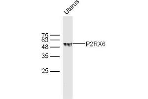 Mouse uterus lysates probed with P2RX6 Polyclonal Antibody, unconjugated  at 1:300 overnight at 4°C followed by a conjugated secondary antibody at 1:10000 for 60 minutes at 37°C. (P2RX6 抗体  (AA 55-160))