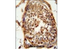 Immunohistochemistry (Paraffin-embedded Sections) (IHC (p)) image for anti-DnaJ (Hsp40) Homolog, Subfamily B, Member 13 (DNAJB13) (AA 176-205) antibody (ABIN654838)