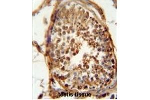 DNAJB13 antibody (Center) (ABIN654838 and ABIN2844507) immunohistochemistry analysis in formalin fixed and paraffin embedded human testis carcinoma followed by peroxidase conjugation of the secondary antibody and DAB staining. (DNAJB13 抗体  (AA 176-205))