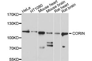 Western blot analysis of extracts of various cell lines, using CORIN antibody. (Corin 抗体)