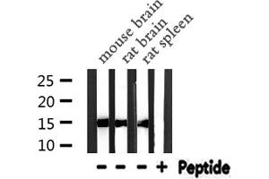 PFN1 抗体  (C-Term)