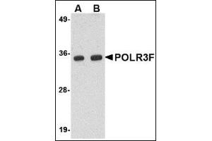 Western blot analysis of POLR3F in human brain tissue lysate with this product at (A) 0.