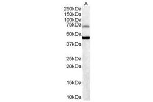 Image no. 1 for anti-Forkhead Box G1 (FOXG1) (C-Term) antibody (ABIN374263) (FOXG1 抗体  (C-Term))