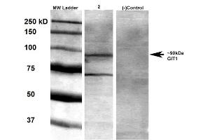 Western Blot analysis of Rat brain membrane lysate showing detection of GIT1 protein using Mouse Anti-GIT1 Monoclonal Antibody, Clone S39B-8 . (GIT1 抗体  (AA 375-770) (Biotin))