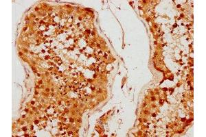 IHC image of ABIN7159140 diluted at 1:500 and staining in paraffin-embedded human testis tissue performed on a Leica BondTM system. (MED26 抗体  (AA 372-523))