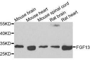 Western blot analysis of extracts of various cells, using FGF13 antibody. (FGF13 抗体)